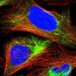 Mucolipin 2 Antibody, Novus Biologicals 0.1mL; Unlabeled:Antibodies, Polyclonal